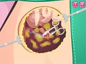 Beauty Ella Appendix Surgery Online Game