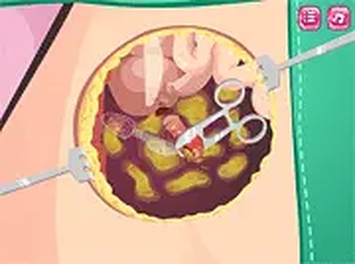 Beauty Ella Appendix Surgery Online Game